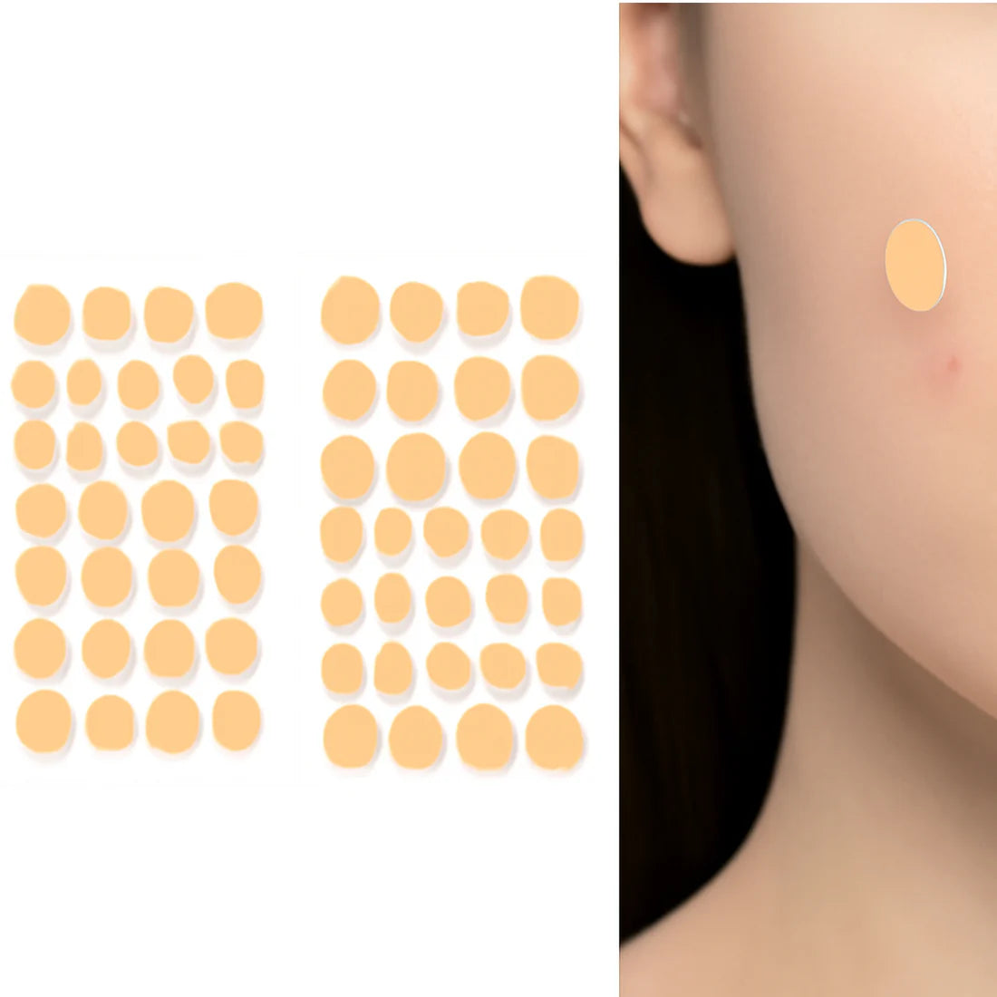 Pimple Patches – Hydrocolloid & Tea Tree Oil for Acne | GlowForm